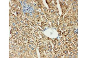 Anti-MTCO1 antibody,  IHC(P) IHC(P): Mouse Liver Tissue