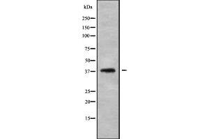 Western blot analysis of LT4R1 using HepG2 whole cell lysates (Leukotriene B4 Receptor/BLT anticorps)