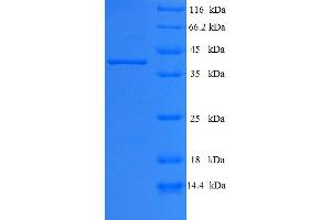 SDS-PAGE (SDS) image for Pleckstrin Homology Domain Containing, Family B (Evectins) Member 2 (PLEKHB2) (AA 1-222), (full length) protein (His-SUMO Tag) (ABIN5711638)