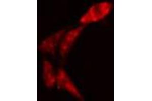 ABIN6274326 staining Hela cells by IF/ICC. (AKAP13 anticorps  (Internal Region))