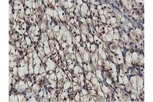 Image no. 3 for anti-V-Akt Murine Thymoma Viral Oncogene Homolog 1 (AKT1) antibody (ABIN1496556) (AKT1 anticorps)