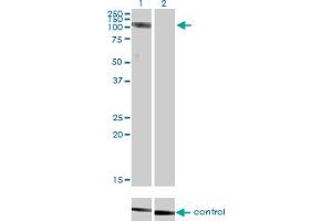 Western blot analysis of CLCN2 over-expressed 293 cell line, cotransfected with CLCN2 Validated Chimera RNAi (Lane 2) or non-transfected control (Lane 1).