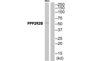 Western blot analysis of extracts from HeLa cells, using PPP2R2B antibody. (PPP2R2B anticorps  (Internal Region))