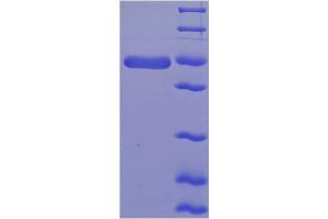 SDS-PAGE (SDS) image for Hydroxysteroid (17-Beta) Dehydrogenase 10 (HSD17B10) (AA 2-261) protein (His-SUMO Tag) (ABIN5711745)