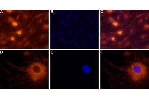 Expression of neuropeptide Y2 receptor in rat dorsal root ganglion cells - Immunocytochemical staining of rat dorsal root ganglion (DRG) neurons.