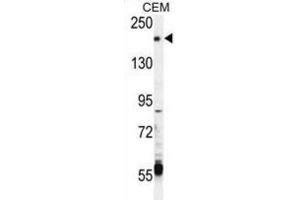 Western Blotting (WB) image for anti-Transient Receptor Potential Cation Channel, Subfamily M, Member 6 (TRPM6) antibody (ABIN3003652) (TRPM6 anticorps)