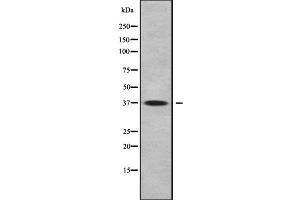 Western blot analysis FAIM2 using COLO205 whole cell lysates (FAIM2 anticorps  (Internal Region))