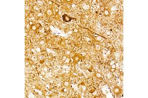 Immunohistochemistry of paraffin-embedded mouse spinal cord using ENO2 Rabbit mAb (ABIN7266959) at dilution of 1:100 (40x lens).