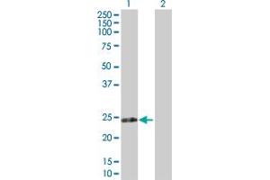 Western Blot analysis of RPIA expression in transfected 293T cell line by RPIA MaxPab polyclonal antibody. (Ribose 5-Phosphate Isomerase A (RPIA) (AA 1-237) anticorps)