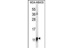 Western blot analysis in MDA-MB435 cell line lysates (35ug/lane). (NDUFAB1 anticorps  (C-Term))