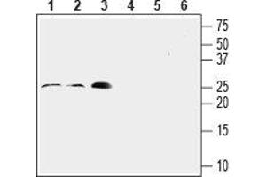 Western blot analysis of rat lung (lanes 1 and 4, 1:200), mouse heart (lanes 2 and 5, 1:200) and rat aortic endothelial cell (RAEC) (lanes 3 and 6, 1:400) lysates: - 1-3. (RAMP2 anticorps  (Extracellular, N-Term))