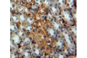 IHC-P analysis of Kidney tissue, with DAB staining. (IRF3 anticorps  (AA 1-360))
