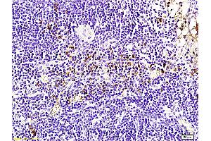 Formalin-fixed and paraffin embedded rabbit pancreas labeled with Anti-Bcl-2 Polyclonal Antibody, Unconjugated (ABIN707156) followed by conjugation to the secondary antibody and DAB staining (Bcl-2 anticorps  (AA 161-239))