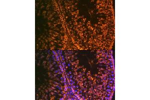 Immunofluorescence analysis of rat testis using Lin28 Rabbit mAb (ABIN7268266) at dilution of 1:100 (40x lens).
