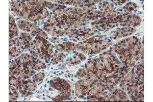 Image no. 9 for anti-Dual Specificity Phosphatase and Pro Isomerase Domain Containing 1 (DUPD1) antibody (ABIN1497927)