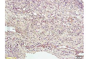 Formalin-fixed and paraffin embedded rat bile duct tissue labeled with Anti-CD34 Polyclonal Antibody, Unconjugated (ABIN676898) at 1:200 followed by conjugation to the secondary antibody and DAB staining (CD34 anticorps  (AA 201-300))