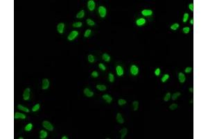 Immunofluorescence staining of Hela cells with ABIN7127487 at 1:25, counter-stained with DAPI. (Recombinant FEN1 anticorps)