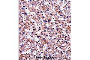 TAGLN2 Antibody (C-term) ((ABIN657984 and ABIN2846931))immunohistochemistry analysis in formalin fixed and paraffin embedded human liver tissue followed by peroxidase conjugation of the secondary antibody and DAB staining.