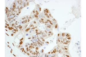 Immunohistochemistry (IHC) image for anti-Karyopherin (Importin) alpha 4 (KPNA4) (AA 471-521) antibody (ABIN7448983) (KPNA4 anticorps  (AA 471-521))