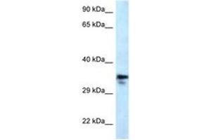 Image no. 1 for anti-Methylmalonic Aciduria (Cobalamin Deficiency) CblC Type, with Homocystinuria (MMACHC) (AA 190-239) antibody (ABIN6747634) (MMACHC anticorps  (AA 190-239))