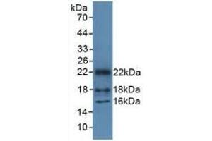 Detection of Recombinant HMGN1, Mouse using Polyclonal Antibody to High Mobility Group Nucleosome Binding Domain Protein 1 (HMGN1) (HMGN1 anticorps  (AA 1-96))