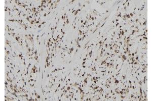 ABIN6273024 at 1/100 staining Human gastric tissue by IHC-P. (USP39 anticorps  (N-Term))