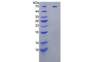 SDS-PAGE analysis of Human KIR2DL1 Protein. (KIR2DL1 Protéine)