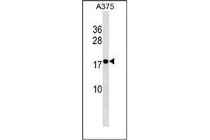 Western blot analysis of RhoF Antibody (C-term) in A375 cell line lysates (35ug/lane).