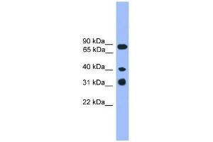 Western Blot showing LAX1 antibody used at a concentration of 1-2 ug/ml to detect its target protein. (LAX1 anticorps  (C-Term))