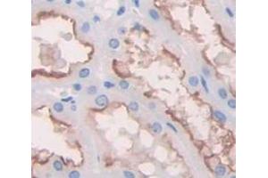 IHC-P analysis of Human Tissue, with DAB staining. (SLC3A2 anticorps  (AA 270-406))