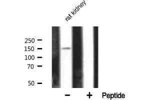 Western blot analysis of PLCG1 expression in rat kidney tissue lysates,The lane on the right is treated with the antigen-specific peptide.