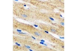 Immunohistochemical analysis of p67 phox staining in mouse heart formalin fixed paraffin embedded tissue section. (NCF2 anticorps)