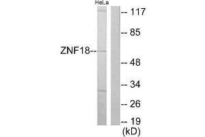 Western Blotting (WB) image for anti-Zinc Finger Protein 18 (ZNF18) (Internal Region) antibody (ABIN1849191) (ZNF18 anticorps  (Internal Region))