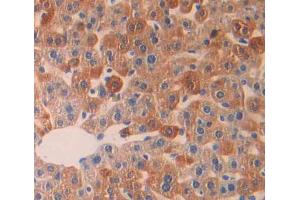 Used in DAB staining on fromalin fixed paraffin- embedded Kidney tissue