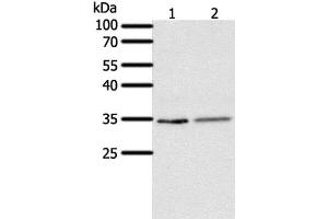 Western Blot analysis of Human fetal lung tissue and A549 cell using SFTPA1 Polyclonal Antibody at dilution of 1:300 (Surfactant Protein A1 anticorps)