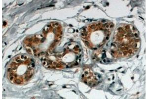 ABIN185147 (4µg/ml) staining of paraffin embedded Human Breast. (SNX5 anticorps  (C-Term))