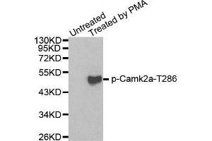 Western blot analysis of extracts from 293 cells using Phospho-Camk2a-T286 antibody. (CAMK2A anticorps  (pThr286))