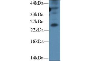 Detection of GREM1 in Mouse Spleen lysate using Polyclonal Antibody to Gremlin 1 (GREM1) (GREM1 anticorps  (AA 25-184))