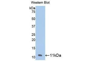 Western blot analysis of the recombinant protein. (beta-Thromboglobulin anticorps  (AA 59-128))