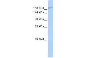 WB Suggested Anti-SUPT6H Antibody Titration: 0. (Spt6 anticorps  (N-Term))