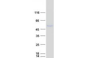 Validation with Western Blot