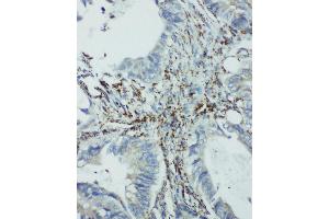anti-Eukaryotic Translation Initiation Factor 6 (EIF6) (AA 82-96), (Middle Region) antibody