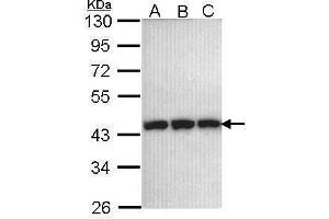 WB Image Sample (30 ug of whole cell lysate) A: 293T B: A431 , C: H1299 10% SDS PAGE antibody diluted at 1:1000 (PGK1 anticorps)