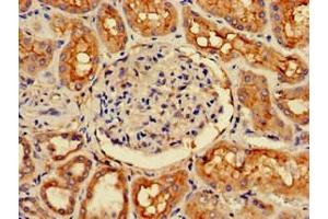 Immunohistochemistry of paraffin-embedded human kidney tissue using ABIN7147230 at dilution of 1:100 (CDK5RAP2 anticorps  (Regulatory Subunit))
