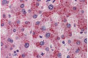 Human Liver: Formalin-Fixed, Paraffin-Embedded (FFPE)