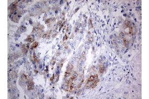 Immunohistochemistry (IHC) image for anti-Chromosome 3 Open Reading Frame 15 (C3orf15) (AA 1-313) antibody (ABIN2715591) (C3orf15 anticorps  (AA 1-313))