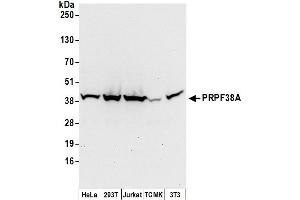 Western Blotting (WB) image for anti-PRP38 Pre-mRNA Processing Factor 38 (Yeast) Domain Containing A (PRPF38A) (AA 262-312) antibody (ABIN7450607)