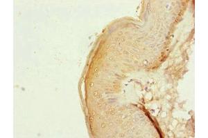 Immunohistochemistry of paraffin-embedded human skin tissue using ABIN7160914 at dilution of 1:100
