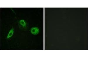 Immunofluorescence analysis of HeLa cells, using PLCG2 (Phospho-Tyr1217) Antibody. (Phospholipase C gamma 2 anticorps  (pTyr1217))