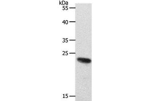 Western Blot analysis of 231 cell using RAMP2 Polyclonal Antibody at dilution of 1:650 (RAMP2 anticorps)